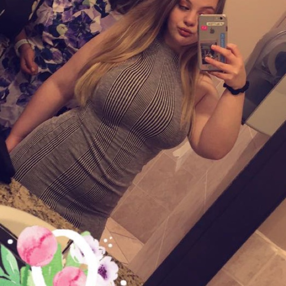 Striped Tight Dress with cutout back!
